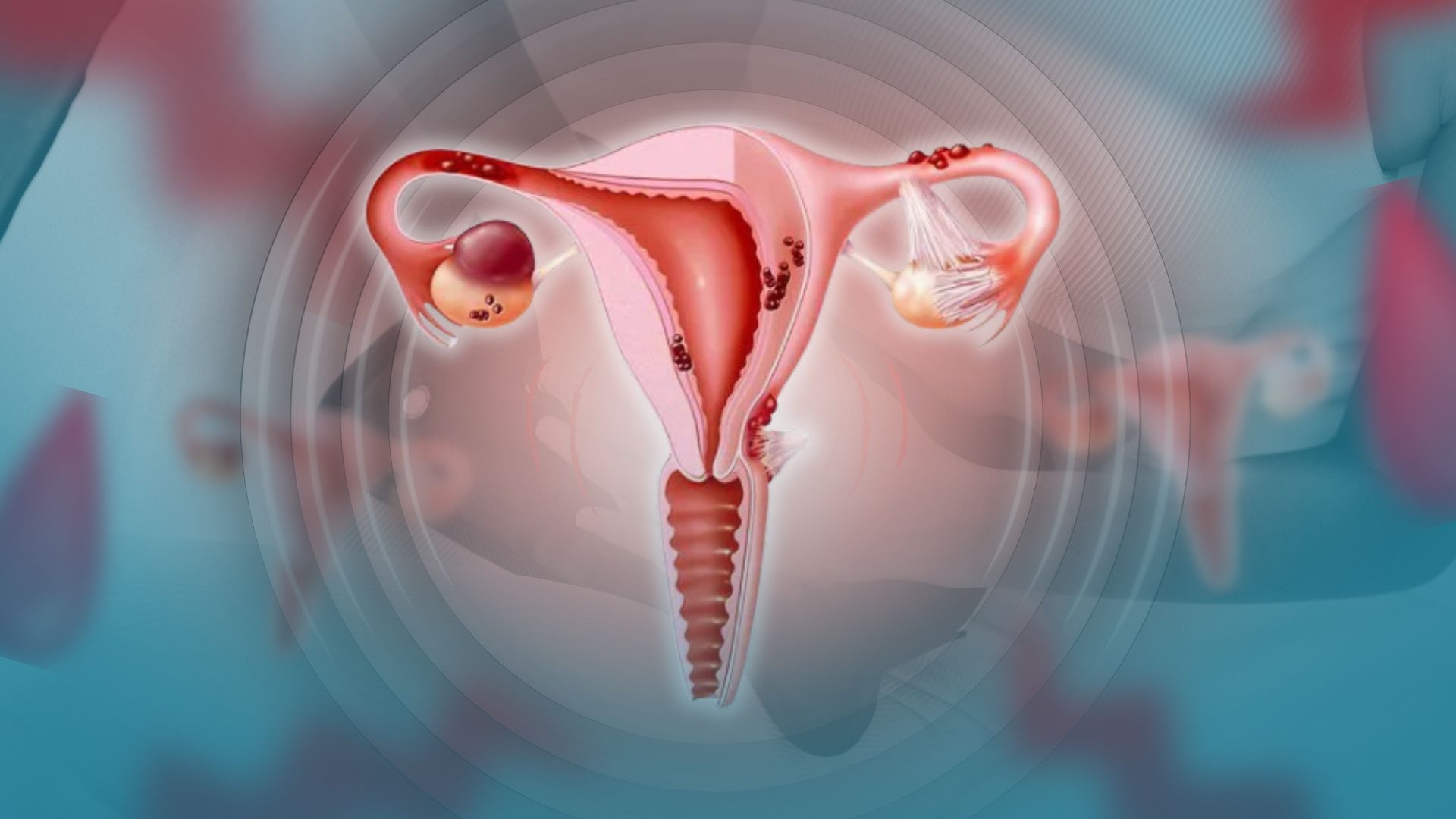 Why are period cramps so painful? Here’s what happens inside your body 