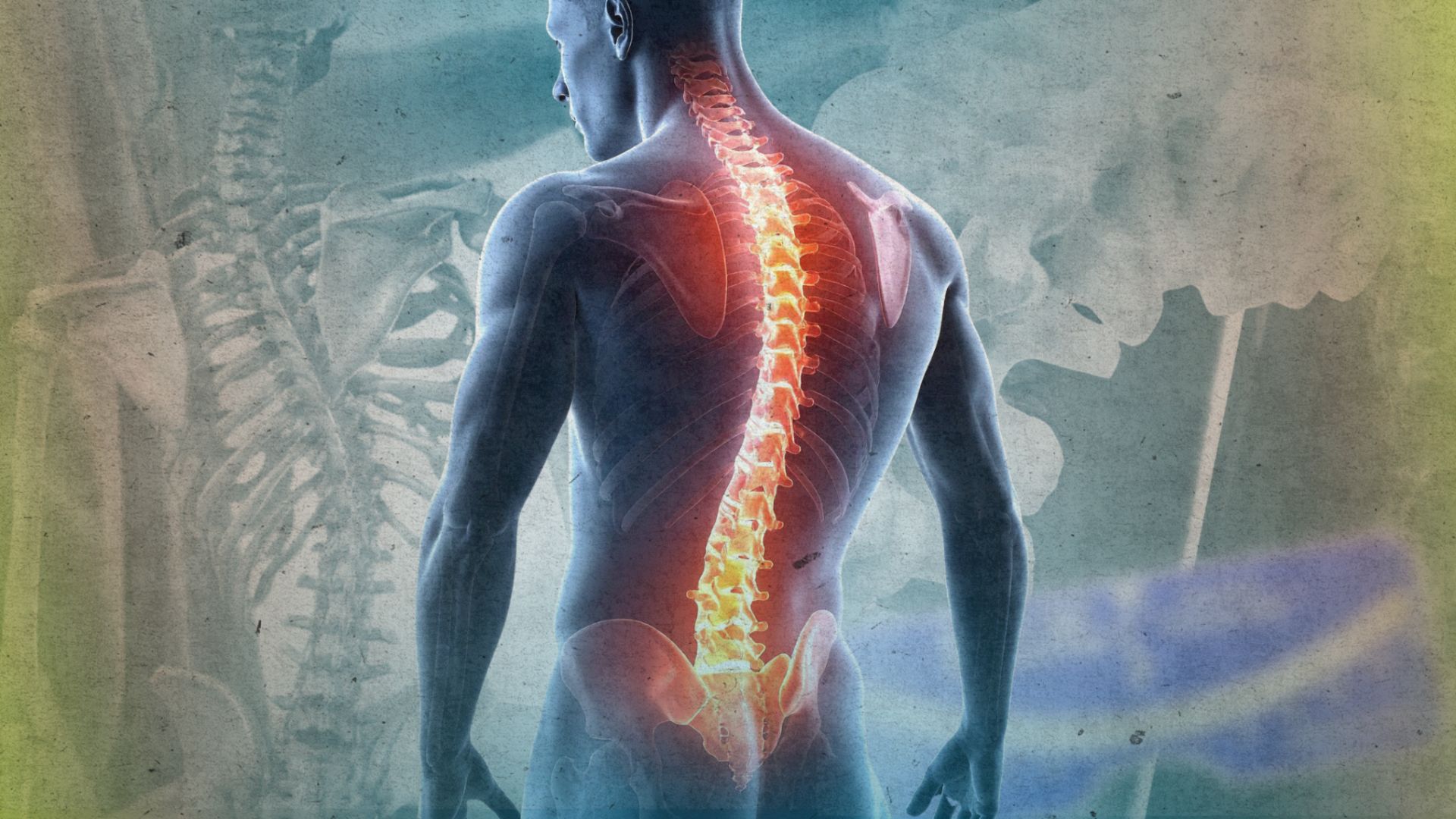 Kakaibang postura ng katawan, posibleng Scoliosis ang dahilan